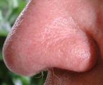 Up the nose