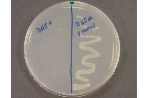 Antibiotic resistance. Antibiotic resistance.