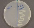 Antibiotic resistance.