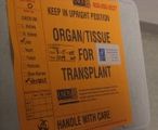 Organ transplant label. 