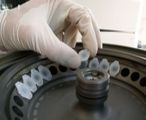 Centrifugation of samples